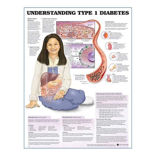 Understanding Typ1 Diabetes plastlaminerad anatomisk plansch